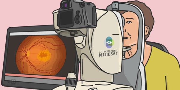 The Interventional Mindset in Glaucoma Care