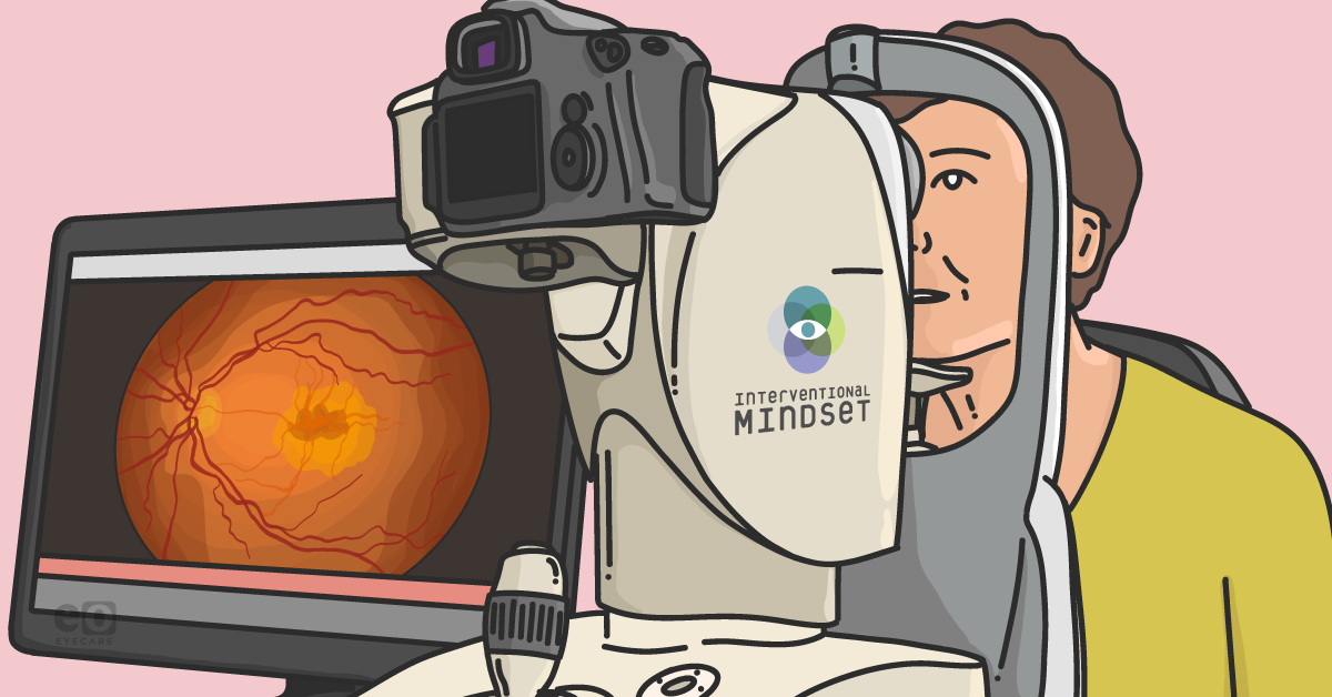 The Interventional Mindset in Glaucoma Care