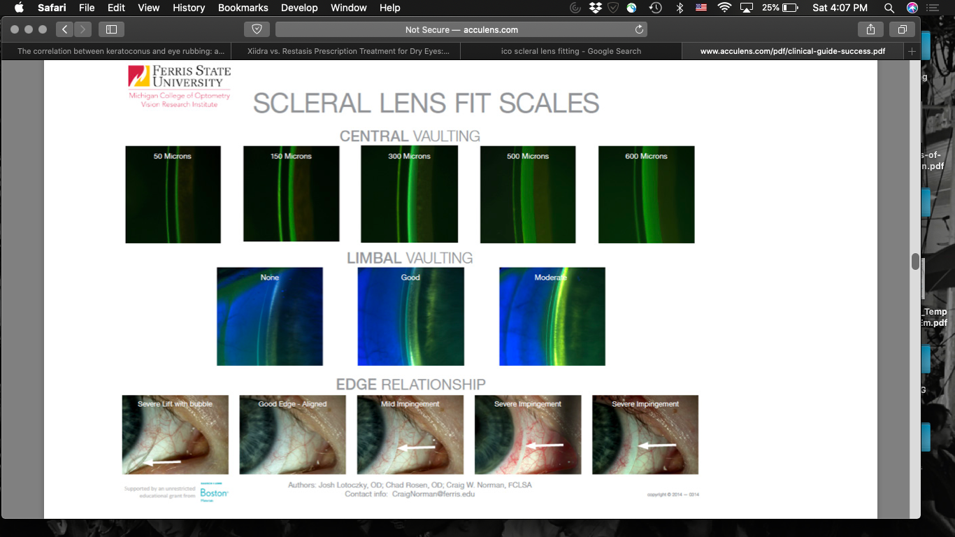 Scleral Lens Fit Scales