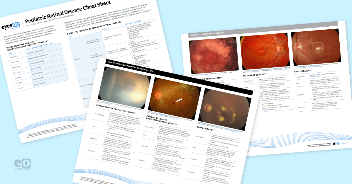 Image of the Pediatric Retinal Disease Cheat Sheet, which features fundus images of 12 pediatric retinal diseases and tips for identifying and managing the conditions.