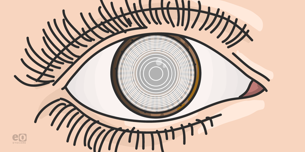 Treating Presbyopia In Cataract Surgery