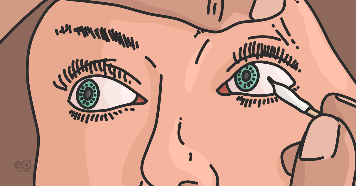 Neurogenic Dry Eye: The Third Category of Dry Eye Disease