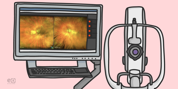 How Ultra-Widefield Imaging Can Boost Your Practice and Benefit Your Patients