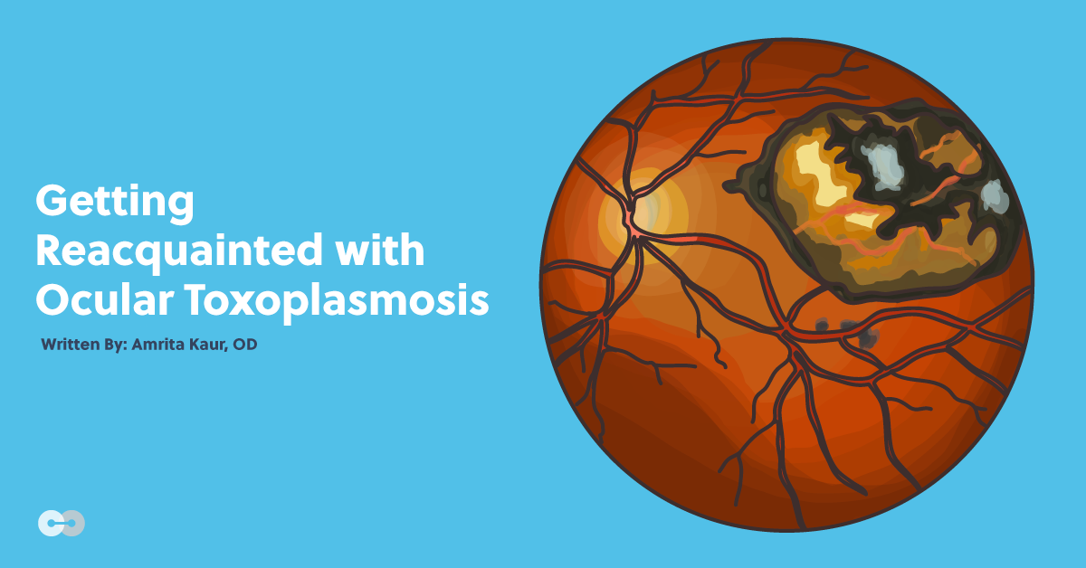 Getting Reacquainted with Ocular Toxoplasmosis