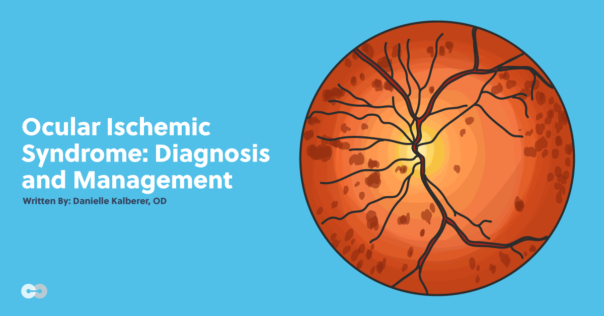 Ocular Ischemic Syndrome: Diagnosis and Management