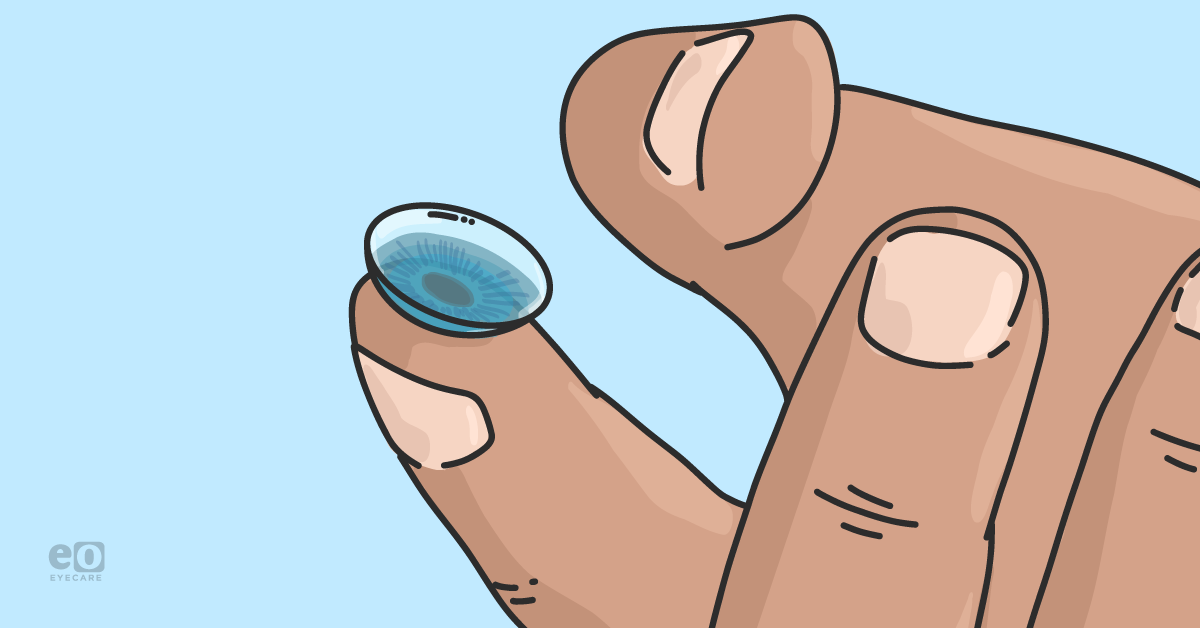 Prosthetic Contact Lenses Fitting for the Blind Eye and Traumatic Iris Injury 