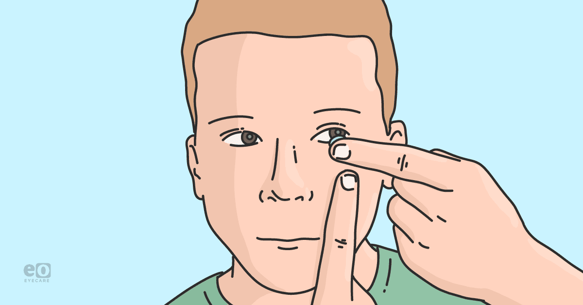 Closeup of a child inserting a contact lens to represent common challenges in prescribing and fitting contact lenses for pediatric patients.