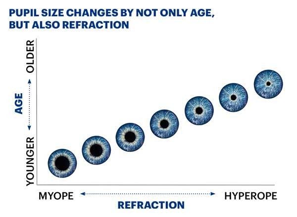 Pupil size change with age and refraction