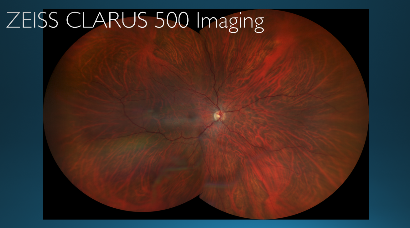 At first glance this retinal image of the patient’s right eye appears to be normal