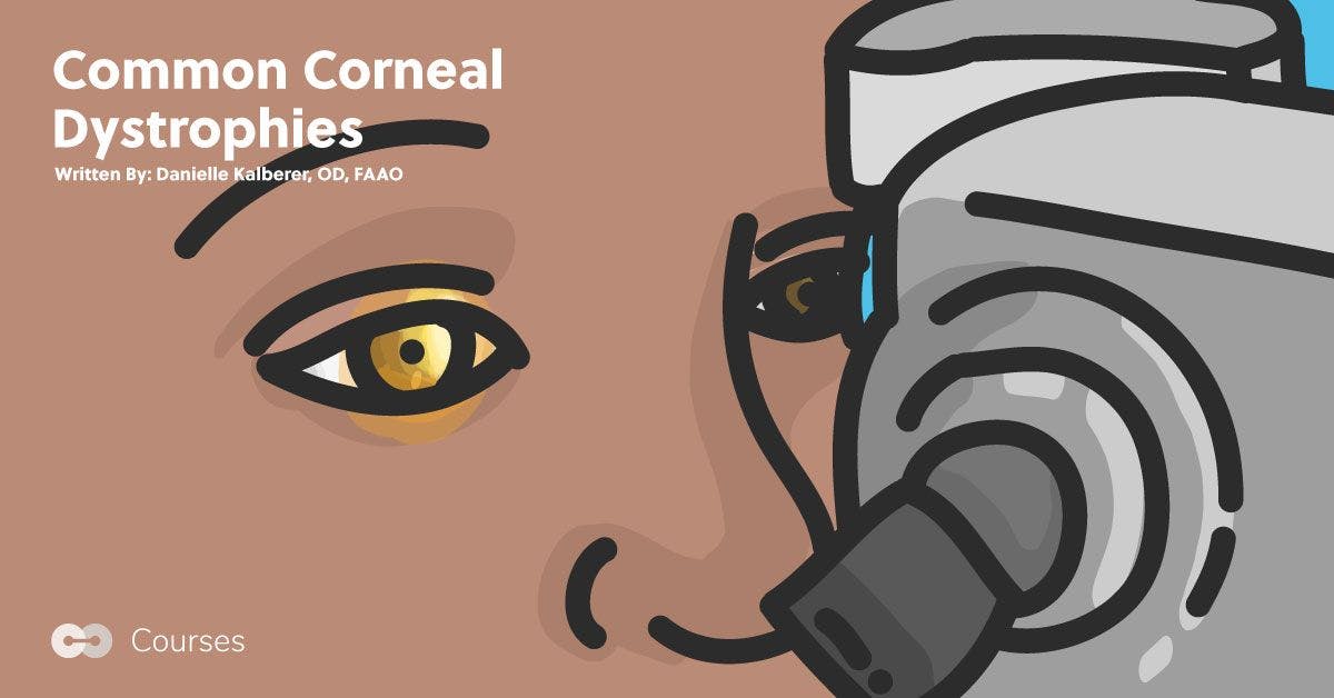Common Corneal Dystrophies