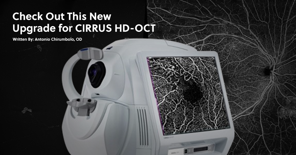 Check Out This New Upgrade For CIRRUS HD-OCT