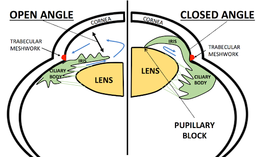narrowing-angle-vs-small-lens.png