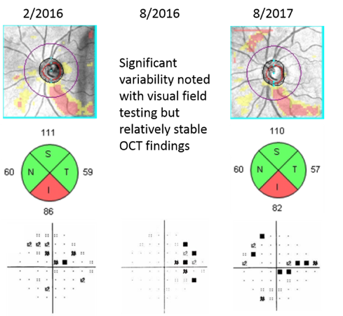 https://covalentcareers3.s3.amazonaws.com/media/original_images/Visual-Field-and-Retinal-Nerve-Fiber-Layer-OCT.png
