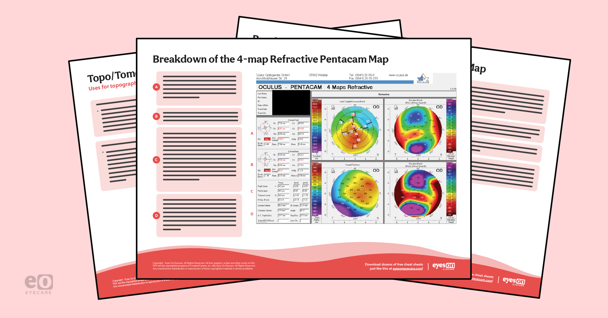 Topography Scan A Guide to Corneal Topography with Cheat Sheet