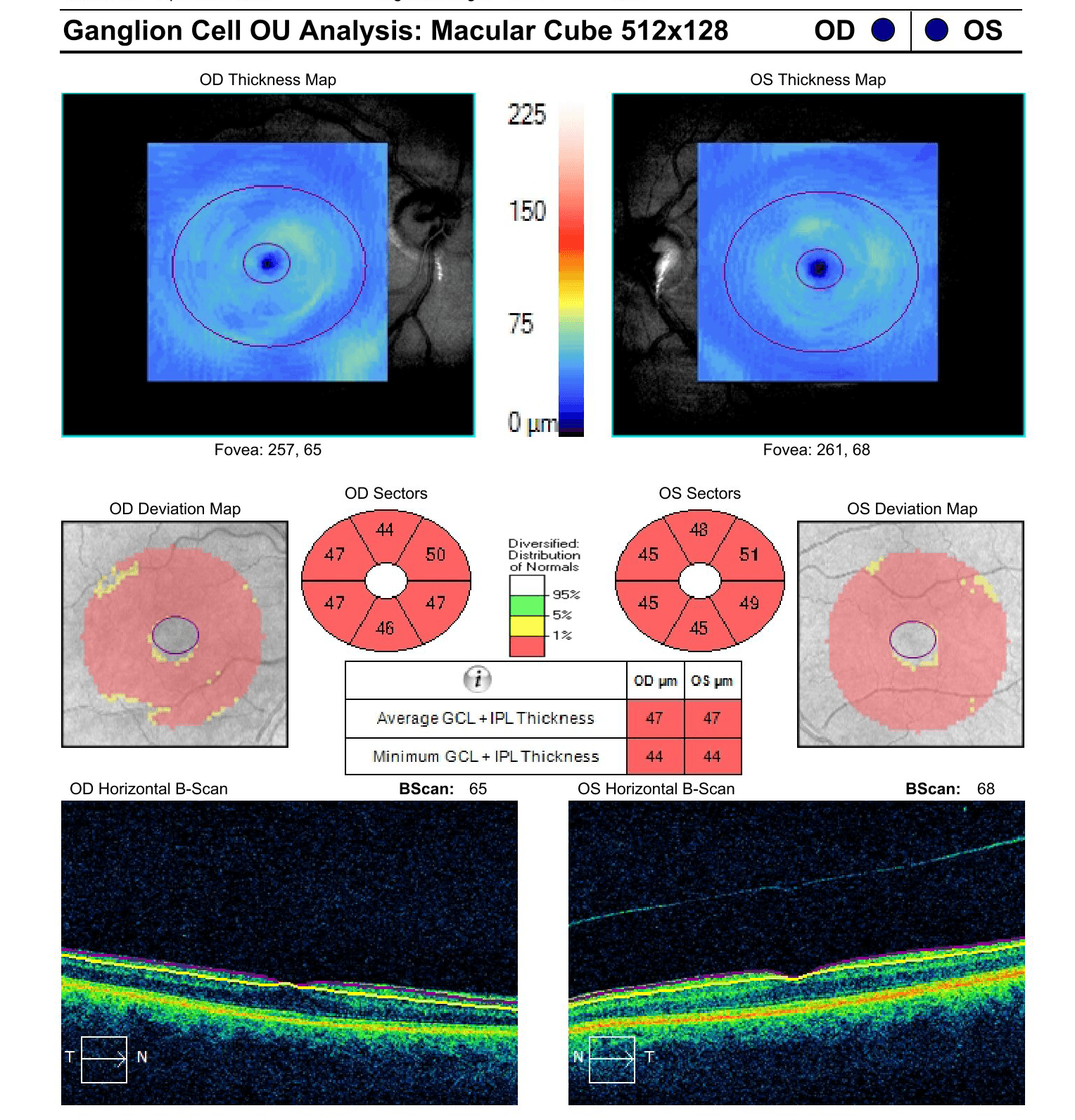 A Guide to Non-Glaucomatous Optic Nerve Disease