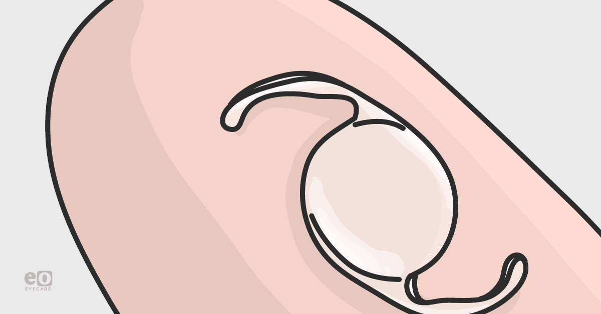 Iol Size Finger The Ultimate Guide to the Most Commonly Used IOLs
