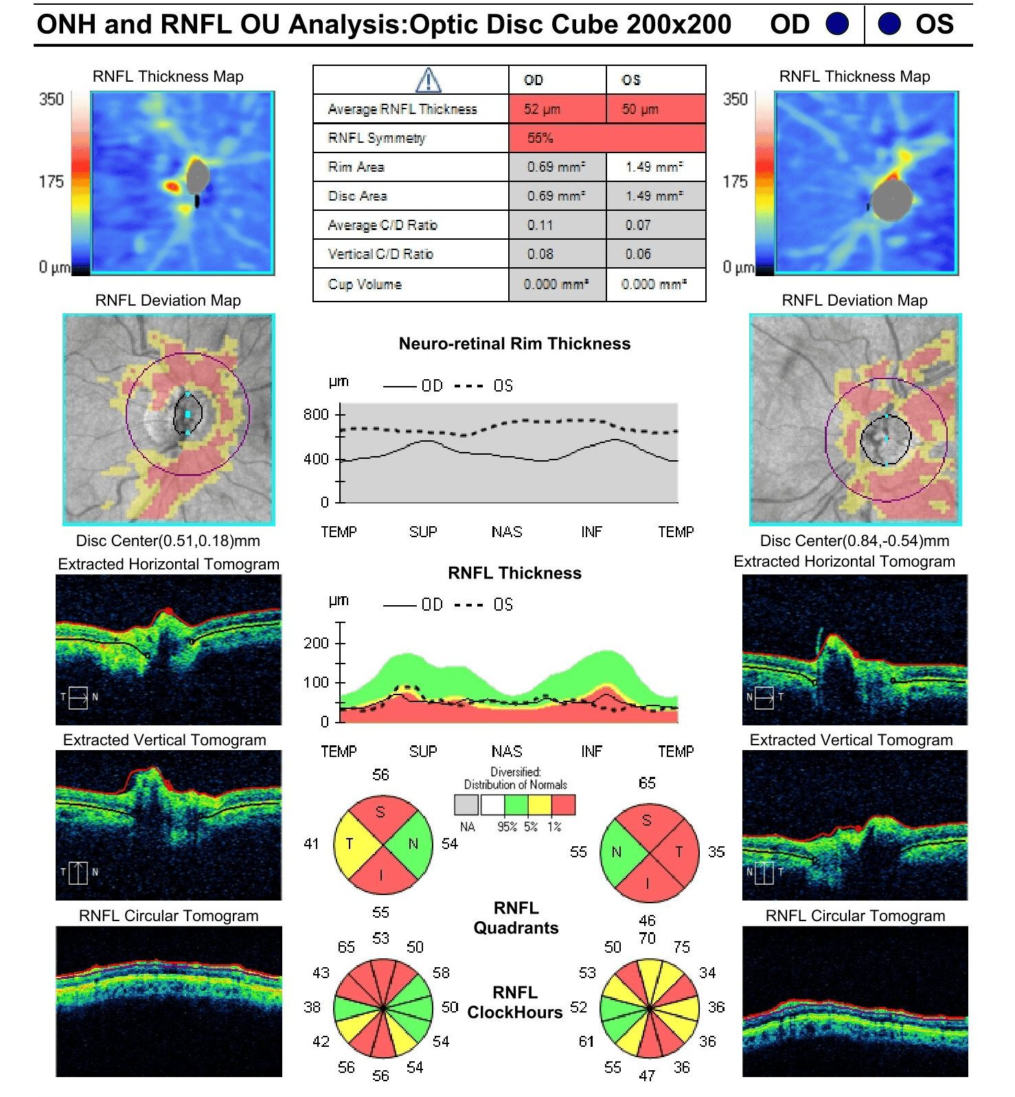 A Guide to Non-Glaucomatous Optic Nerve Disease