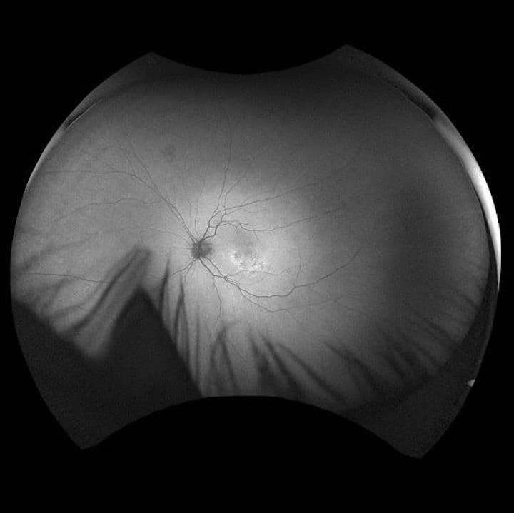 Taking a Deeper Look at the Link Between CSR and AMD with Differential ...