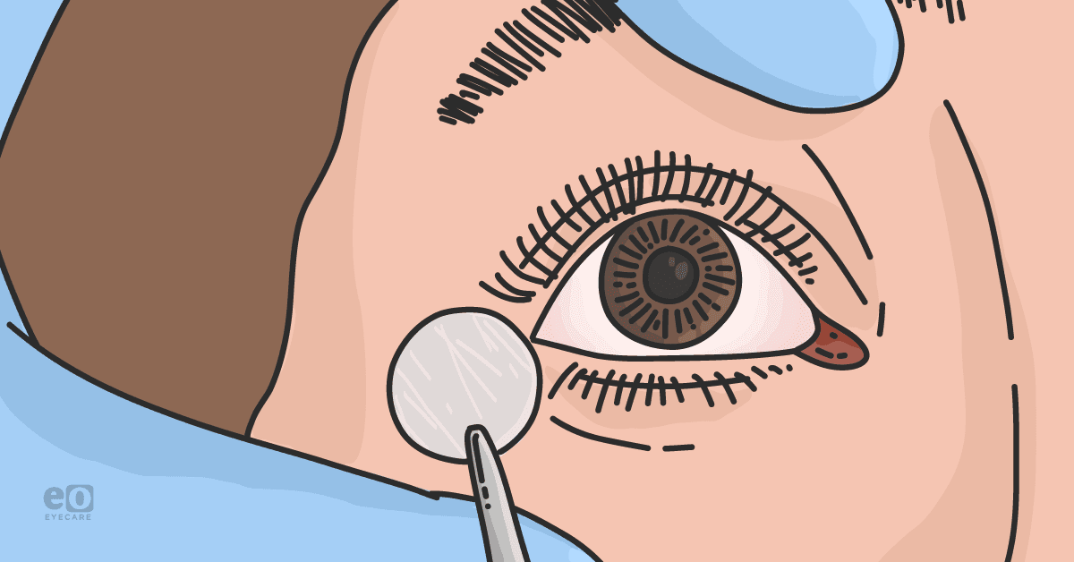 Treatment Primer for Utilizing Amniotic Membrane Tissue