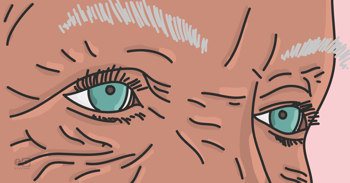 The Ophthalmologist s Map To Charles Bonnet Syndrome the-ophthalmologist-s-map-to-charles-bonnet-syndrome
