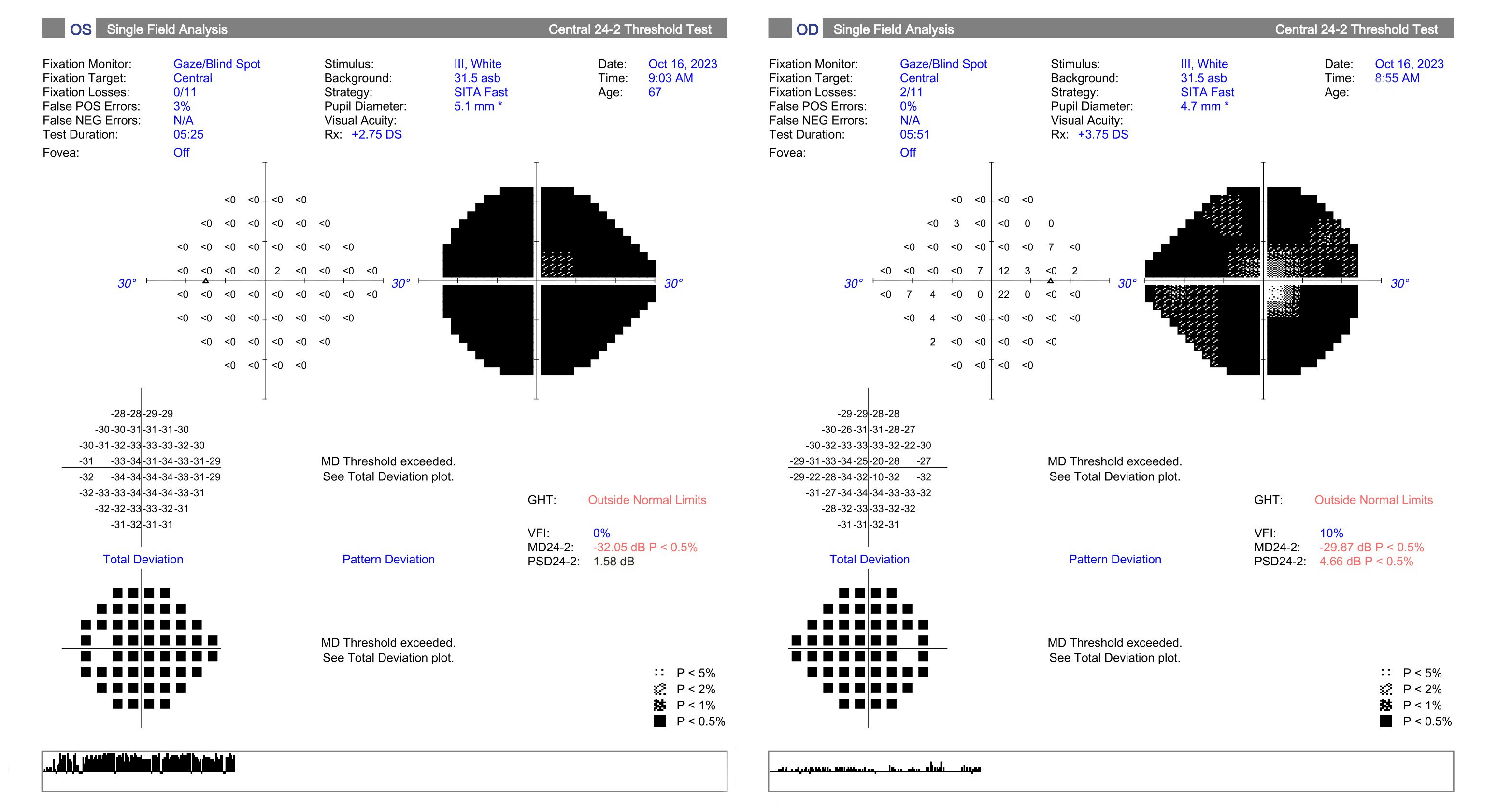 A Guide to Non-Glaucomatous Optic Nerve Disease
