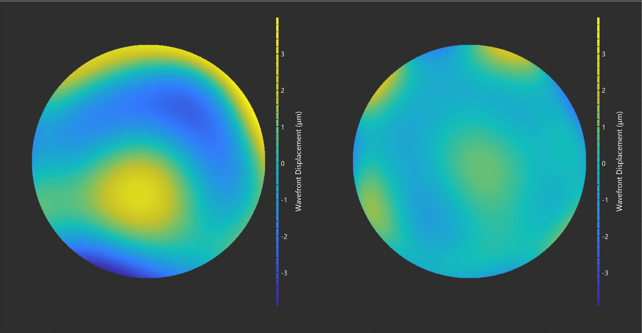 Higher-Order Aberrations: What to Know about Wavefront Scleral Lenses