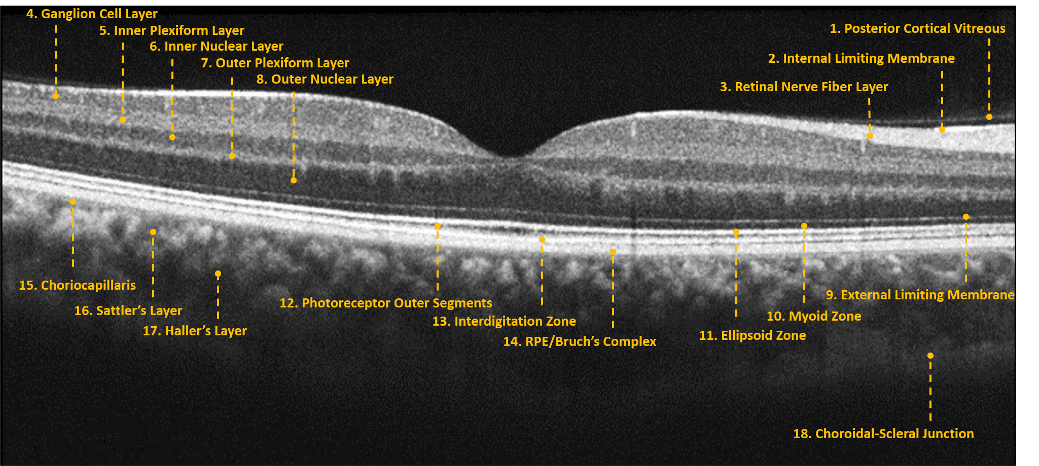 Into the Woods: Interpreting OCT Imaging in Retinal Disease