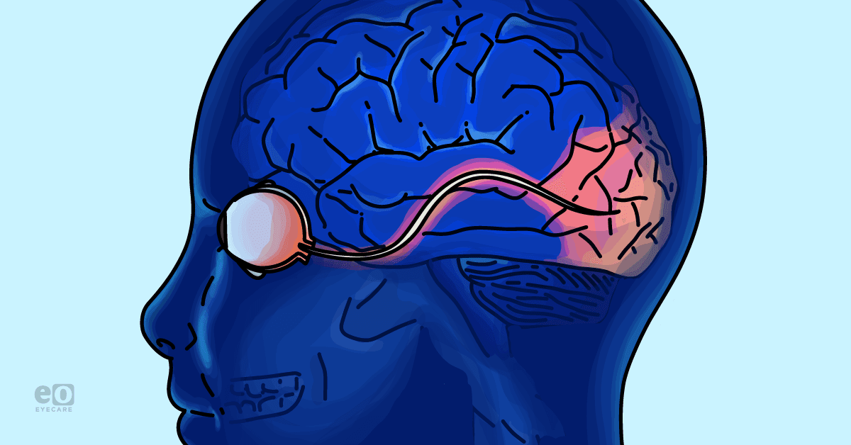 Contralateral Processing For Vision Understanding Cortical Blindness: Essential Guide for Optometrists