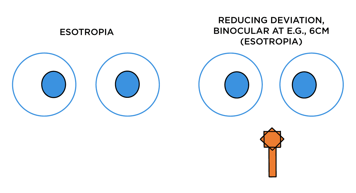 The Simplified Guide to Understanding Eye Movements