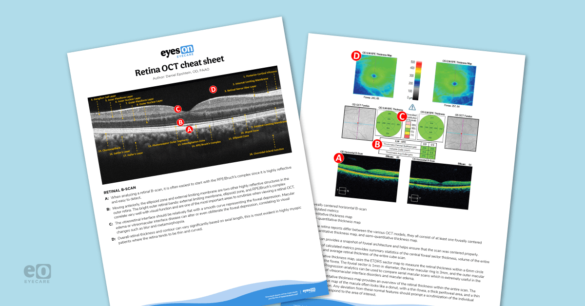 Into the Woods: Interpreting OCT Imaging in Retinal Disease