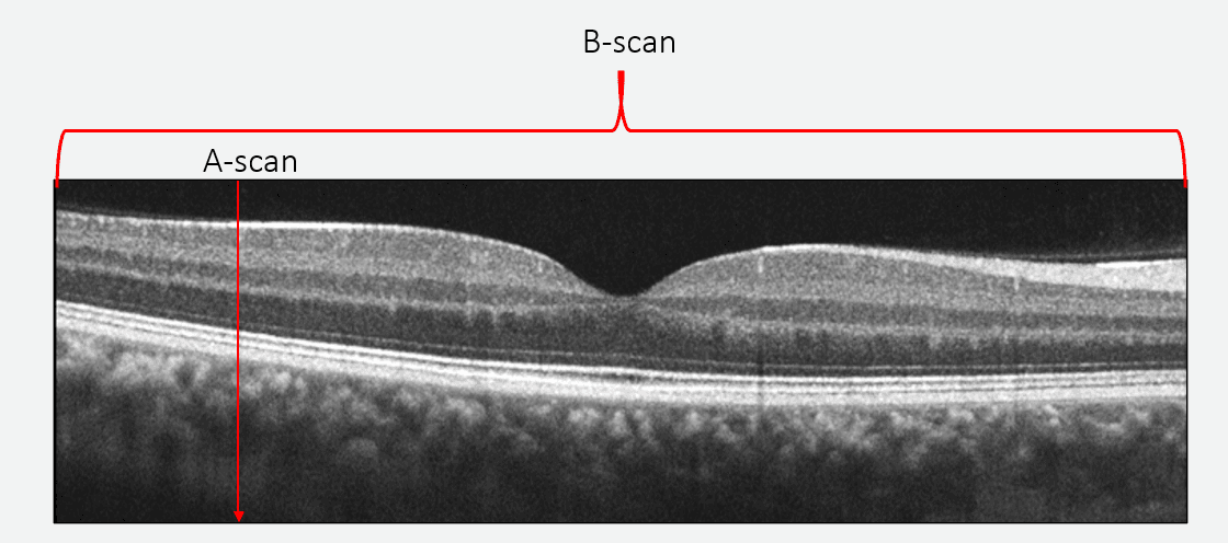 OCT Retinal Bootcamp