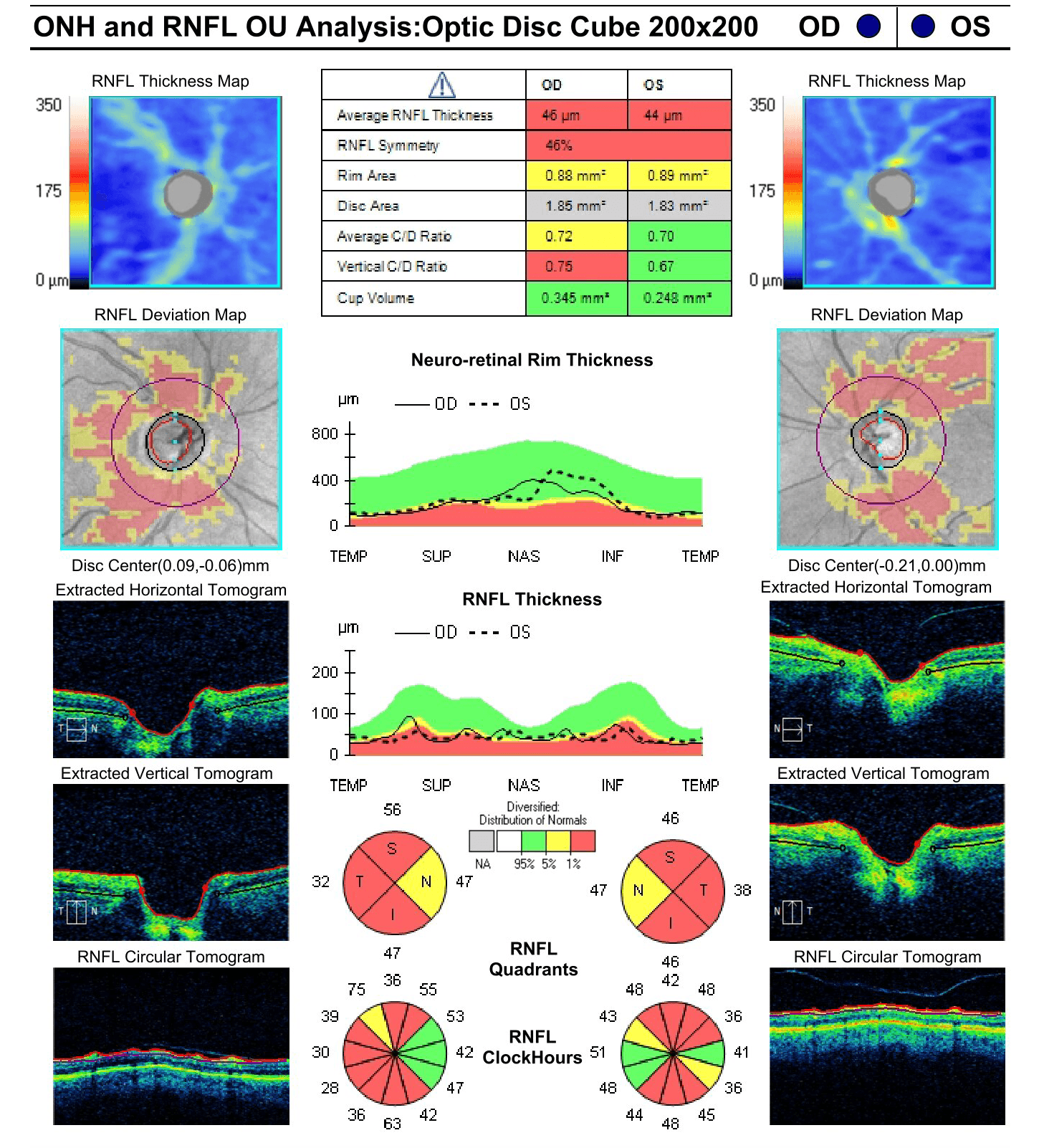 A Guide to Non-Glaucomatous Optic Nerve Disease