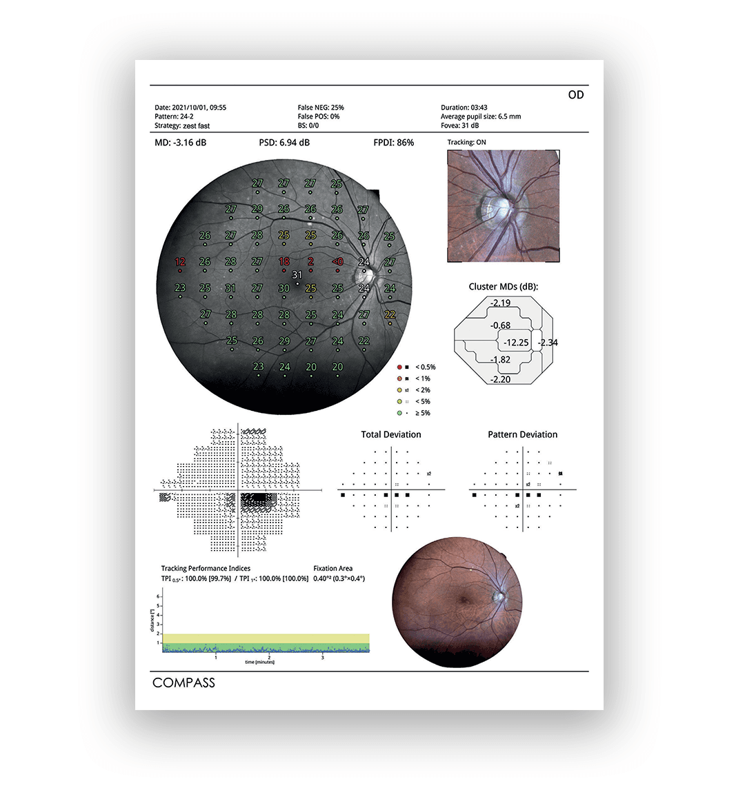 The Ultimate Guide to iCare Imaging and Perimetry