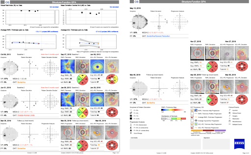Multi Progression Visual Glaucoma Progression: Putting All the Pieces Together