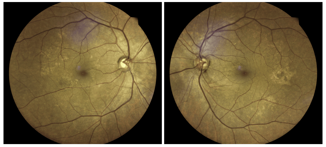 New Trends and Practices in the Diagnosis and Management of Glaucoma