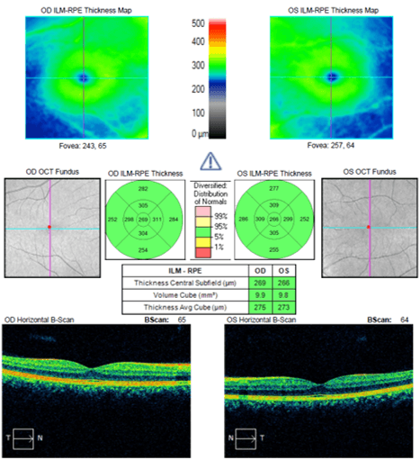 Into the Woods: Interpreting OCT Imaging in Retinal Disease