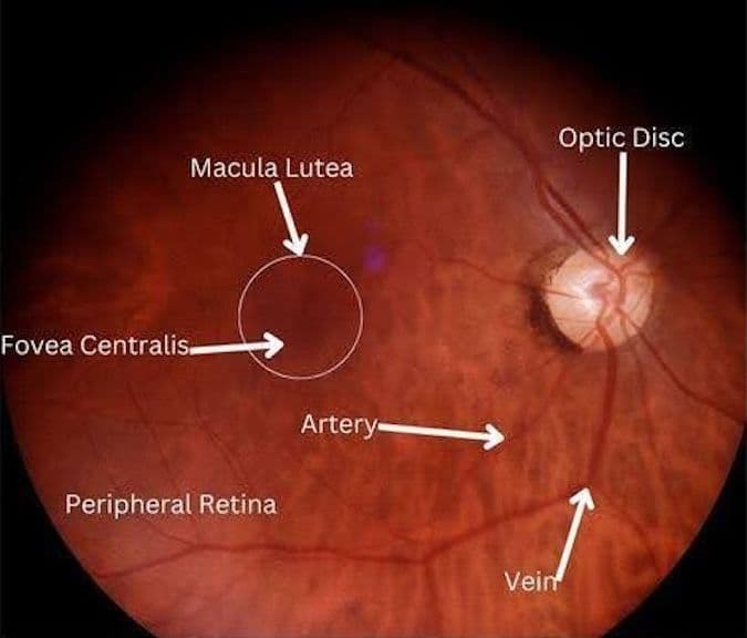 Retinal Background The Ultimate Guide to Identifying Retinal Disease on Fundus Photography