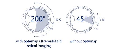 The Ultimate Guide to the Optos® Product Line-Up for Eyecare Professionals