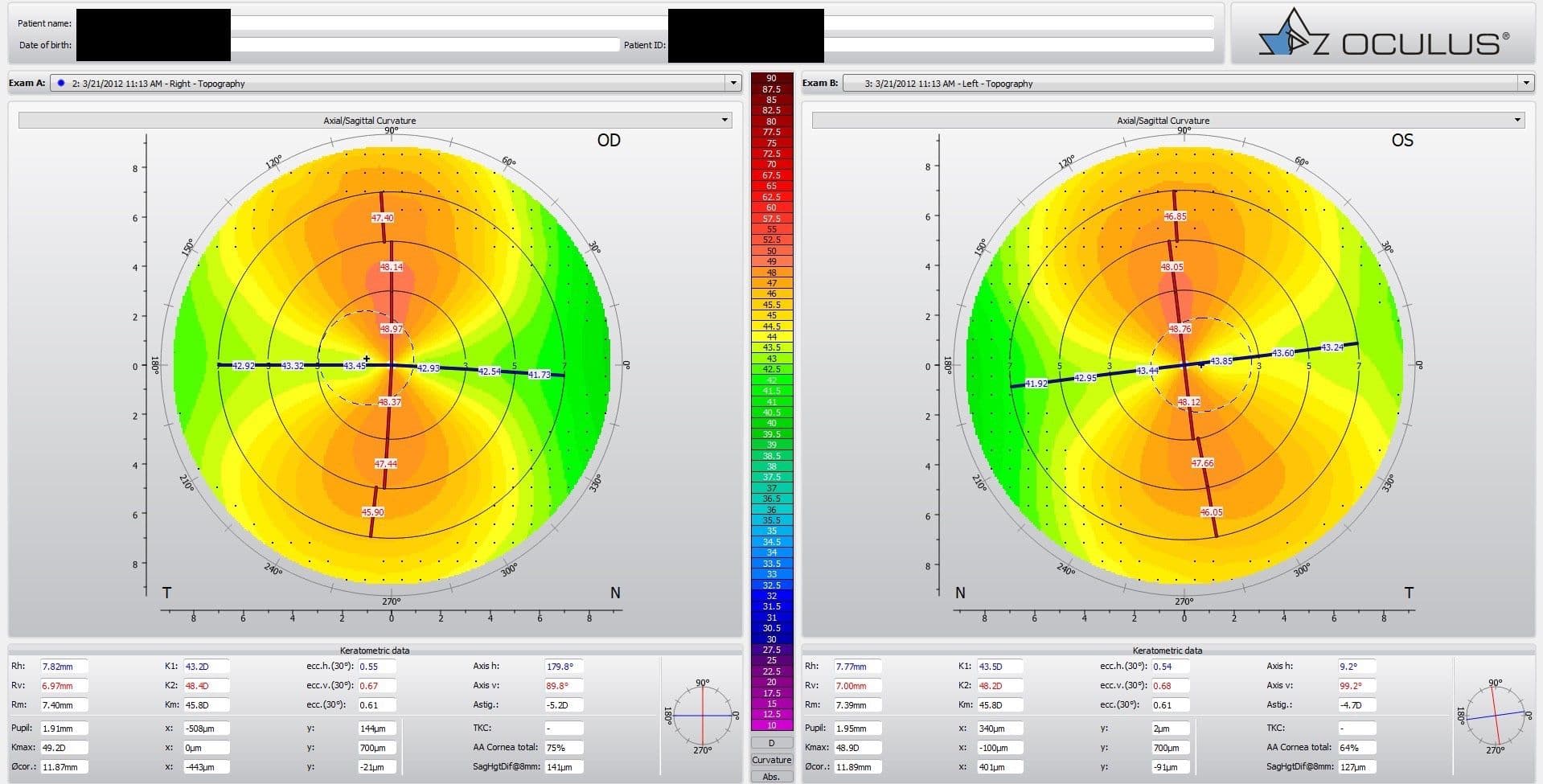 Top 5 Conditions to Treat with Scleral Lenses