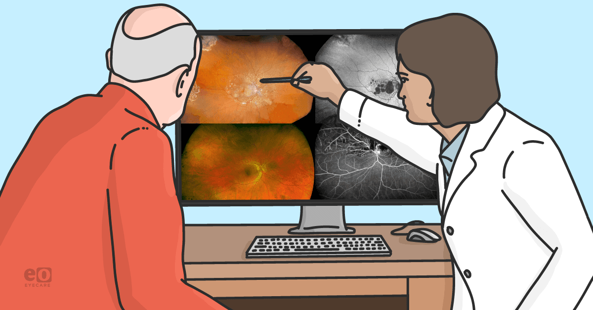 Optos Report The Ultimate Guide to the Optos® Product Line-Up for Eyecare Professionals