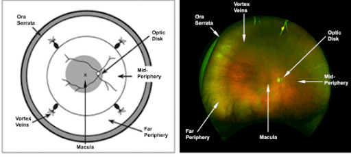 The Ultimate Guide to the Optos® Product Line-Up for Eyecare Professionals
