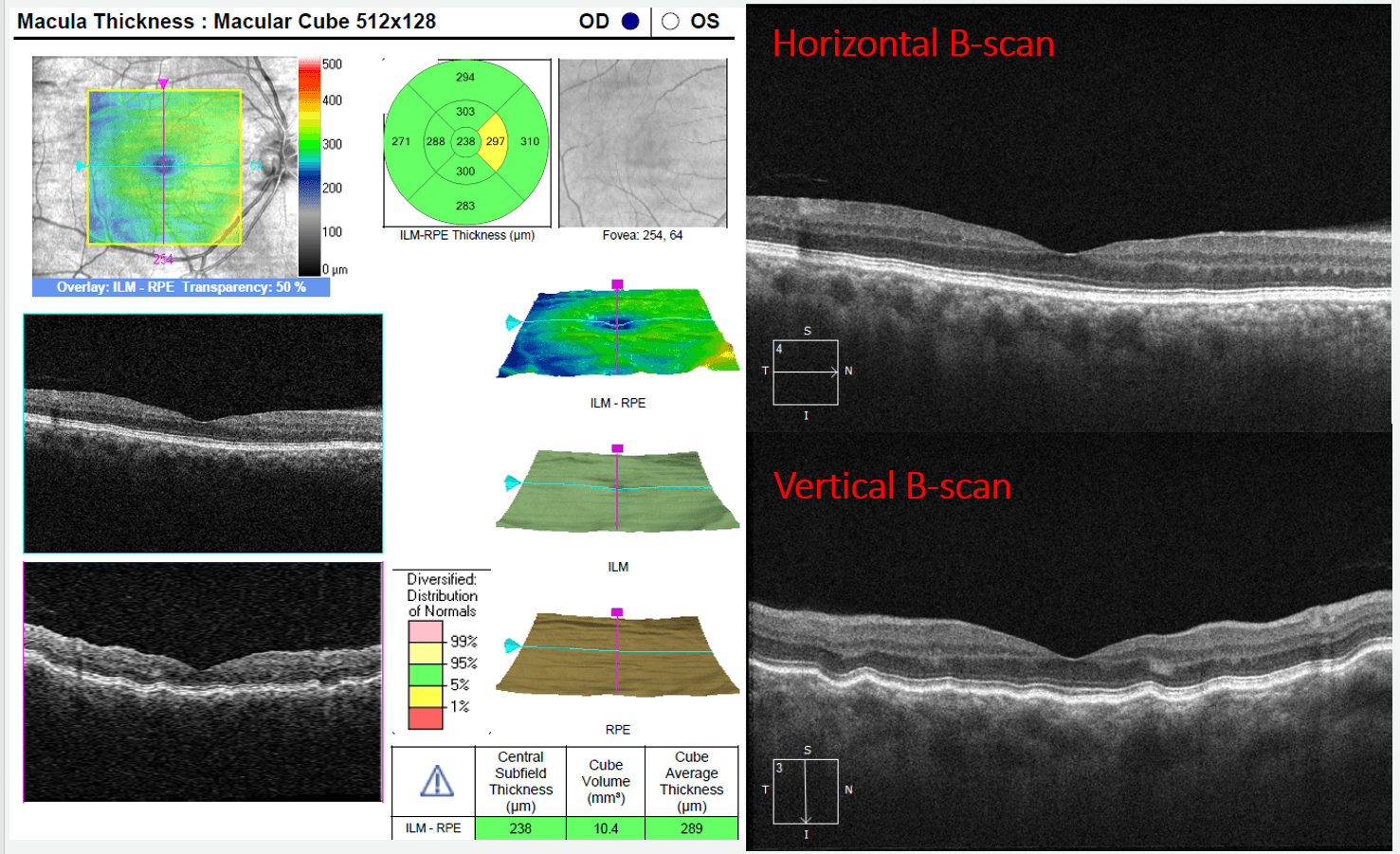 OCT Retinal Bootcamp