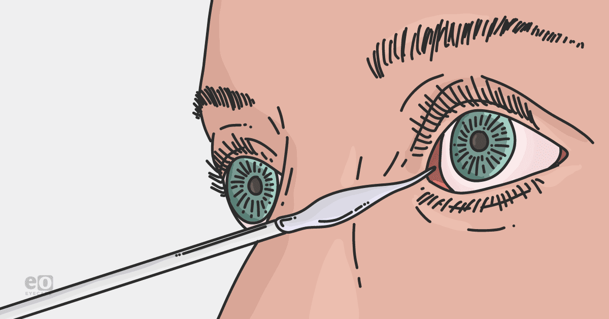 Best Practices in Corneal Sensitivity Testing Best Practices in Corneal Sensitivity Testing