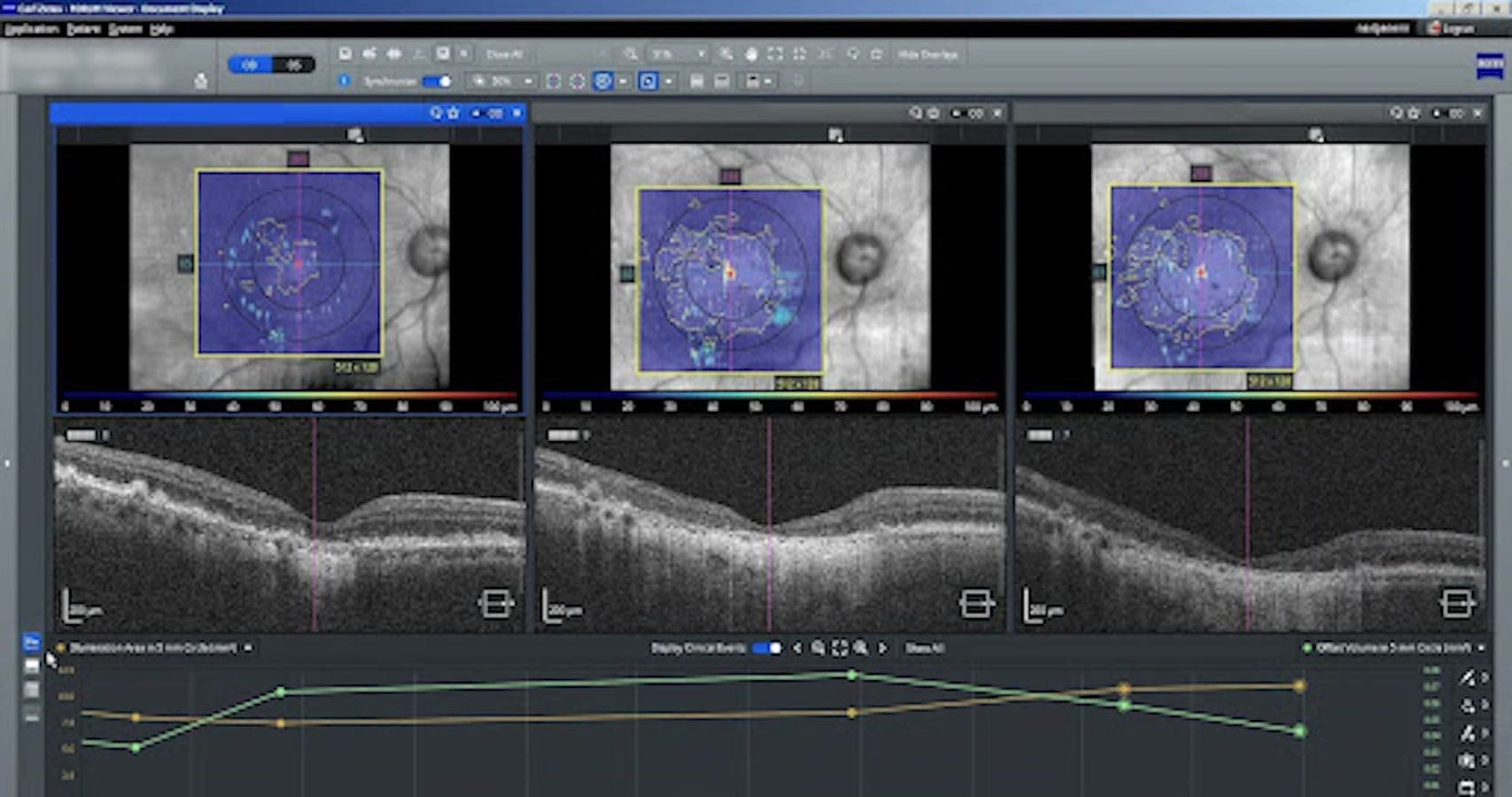Diagnosing and Managing Retinal Disease with Integrated Diagnostics