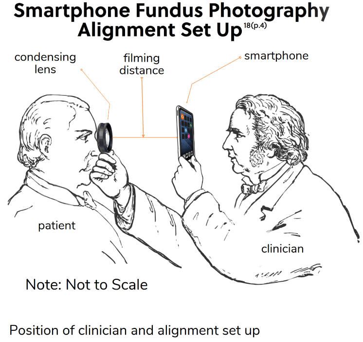 Fundus Capture How to Use a Smartphone for Fundus Photography to Capture Quality ...