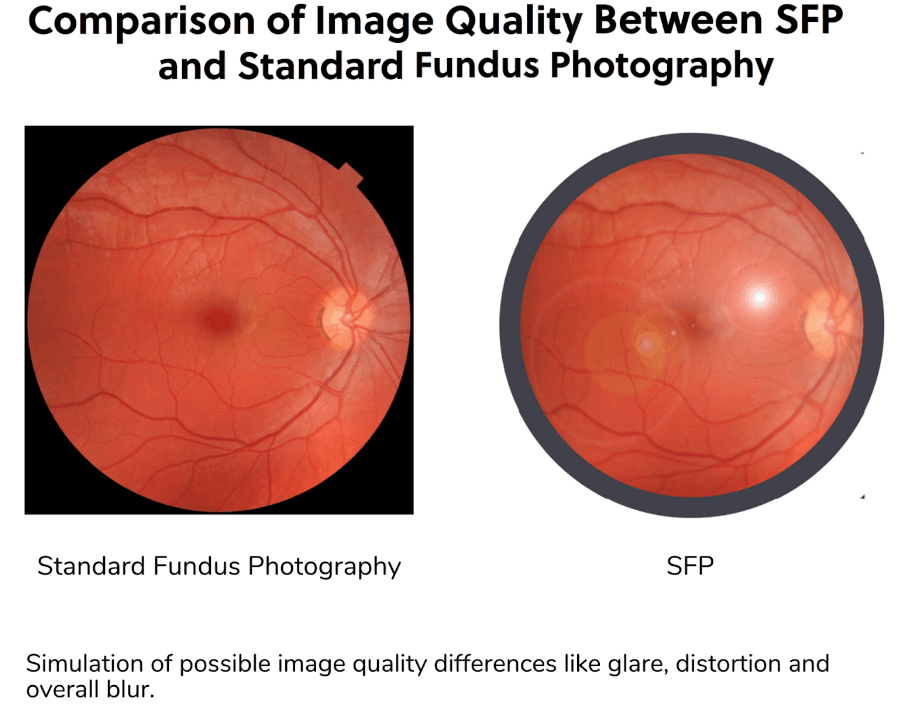 Fundus Capture How to Use a Smartphone for Fundus Photography to Capture Quality ...
