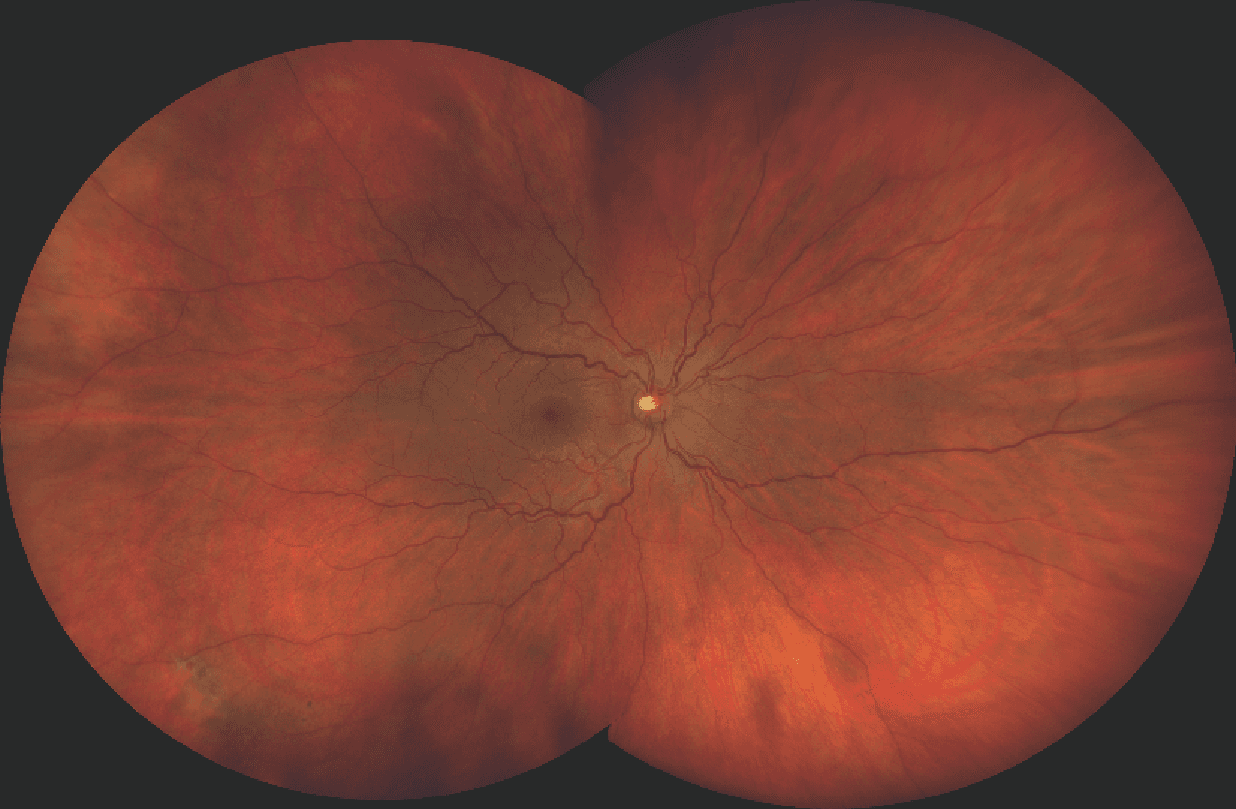 Wrightfields Eye 5 Top Imaging Devices Your Ophthalmology Practice Could Be Overlooking