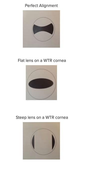 A Quick and Easy Reference Guide to Troubleshooting RGP Lenses