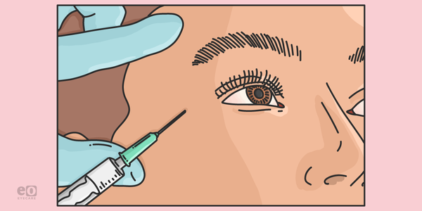 The Top Uses for Botox in Eyecare